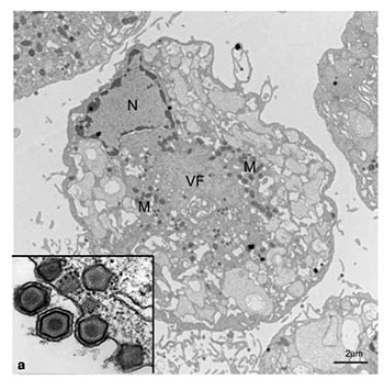 African swine fever virus