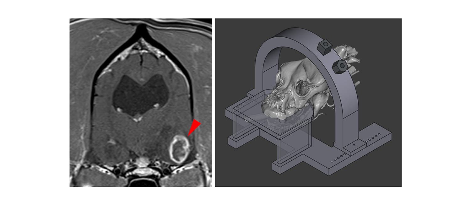 Brain Biopsy images