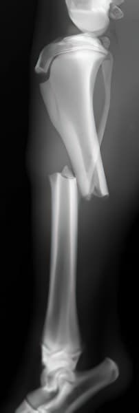 case 1 pre-op radiograph tibia lateral