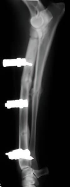 case 2 radiograph 10 week post op lateral