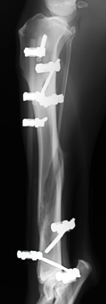case 3: 12 week Post-op radiograph lateral view