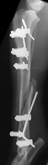 case 3: Post-op radiograph lateral view