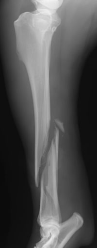 case 3: Pre-op radiograph lateral view
