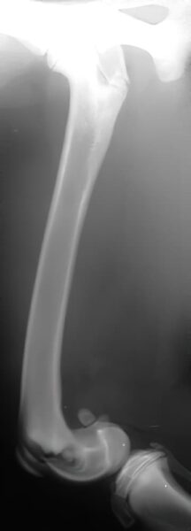 case 6: Pre-op radiograph lateral view
