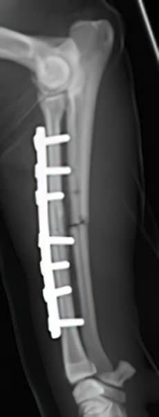 case 7: Post-op radiograph lateral view