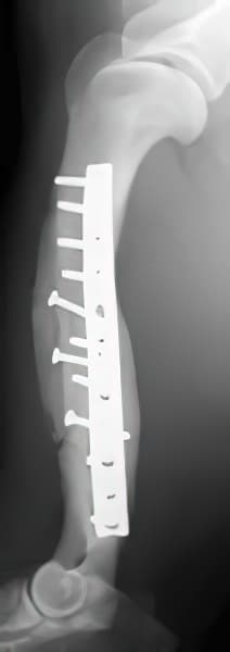 case 9: 12-week post-op radiograph lateral view