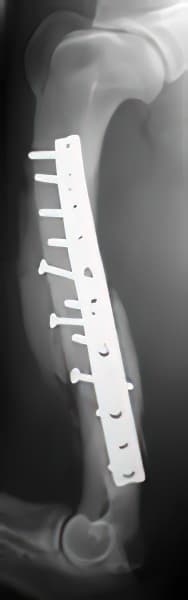 case 9: 6-week post-op radiograph lateral view