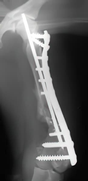 case 10: 6-week post-op radiograph lateral view