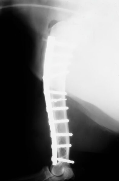 case 11: 4-week post-op radiograph lateral view