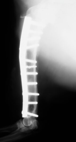 case 11: Post-op radiograph lateral view