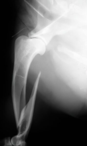 case 11: Pre-op radiograph lateral view