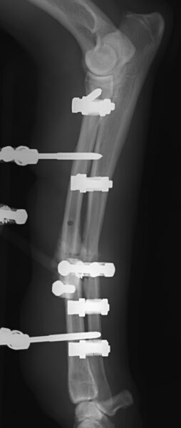 case 12: 6-week post-op radiograph lateral view