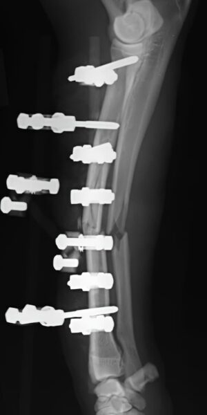 case 12: Post-op radiograph lateral view