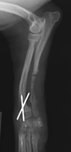 case 13: 4-week post-op radiograph lateral view