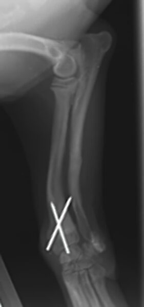 case 13: 8-week post-op radiograph lateral view