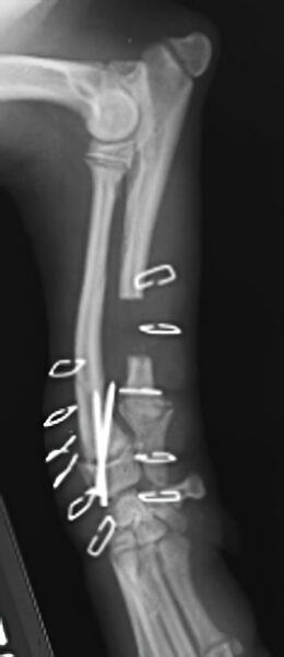 case 13: Post-op radiograph lateral view