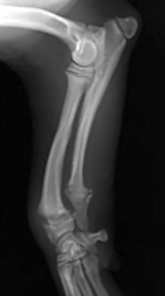 case 13: Pre-op radiograph lateral view