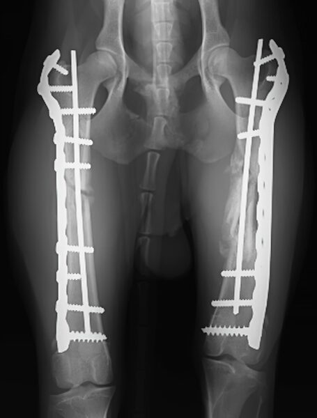 case 14: 6-week post-op radiograph cranial caudal view