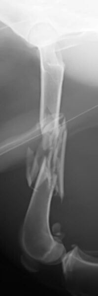 case 14: Pre-op radiograph left lateral view