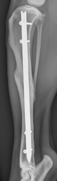 case 15: 14-week post-op radiograph lateral view