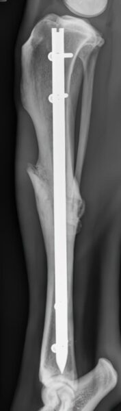 case 15: 8-week post-op radiograph lateral view