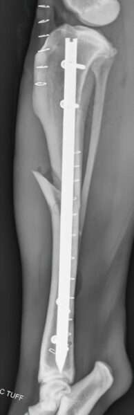 case 15: Post-op radiograph lateral view