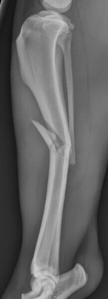 case 15: Pre-op radiograph lateral view