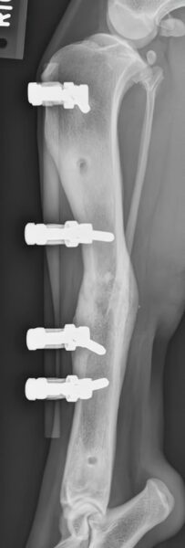 case 16: 18-week post-op radiograph lateral view