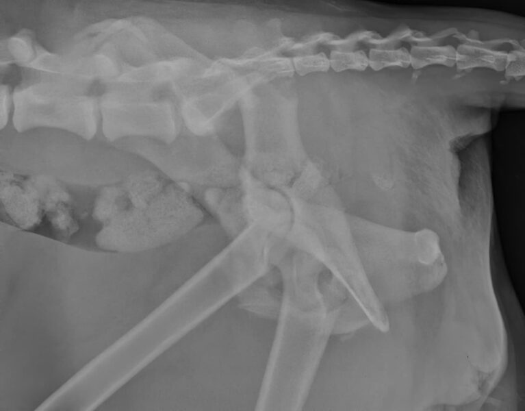 case 18: Pre-op radiograph lateral view