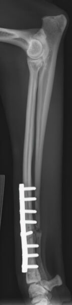case 19: 6-week followup radiograph lateral view