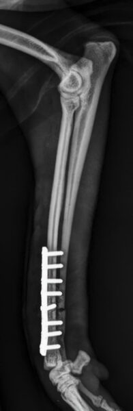 case 19: Post-op radiograph lateral view