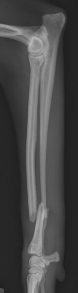 case 19: Pre-op radiograph lateral view
