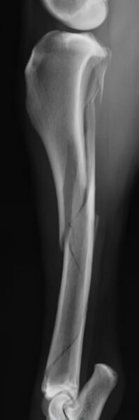 case 20: Pre-op radiograph lateral view