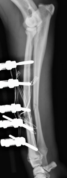 case 21: Post-op radiograph lateral view