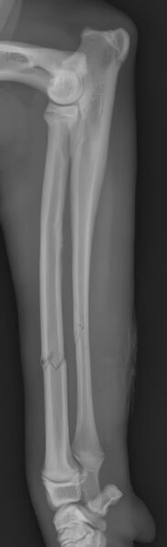 case 21: Pre-op radiograph lateral view