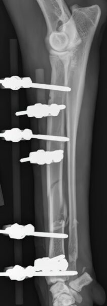 case 22: Post-op radiograph lateral view