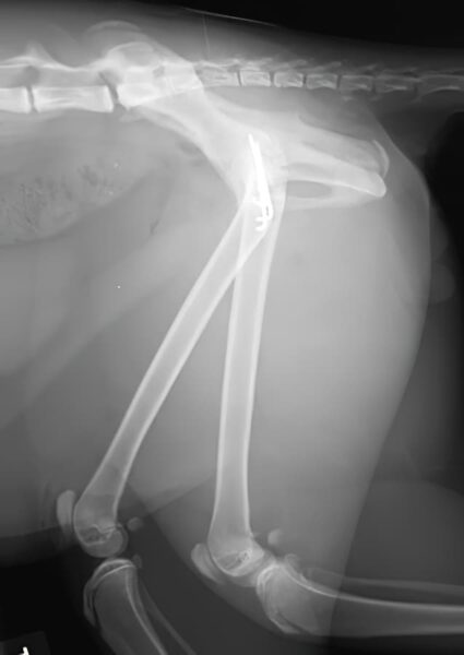 case 25: Post-op radiograph lateral view