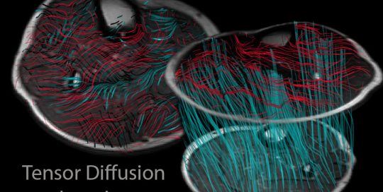 Tensor Diffusion Imaging