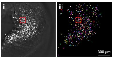 HOMEOSTATIC REGULATION OF NEURAL CIRCUITS