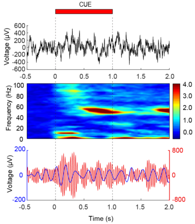 Cross Frequency Coupling