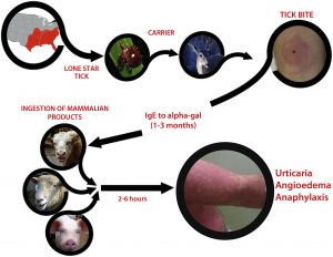 A flow chart depicting how a bite from a lone star tick can result in alpha-gal hypersensitivity.