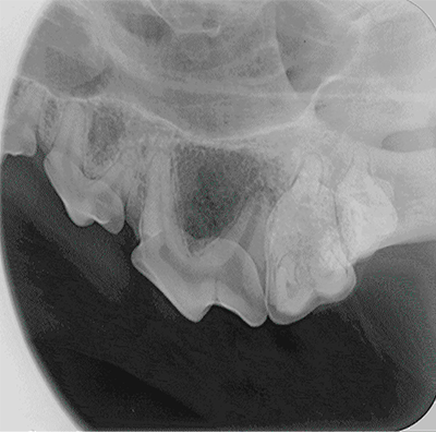 dental radiograph