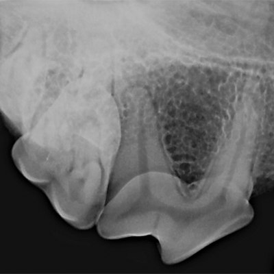 dental radiograph