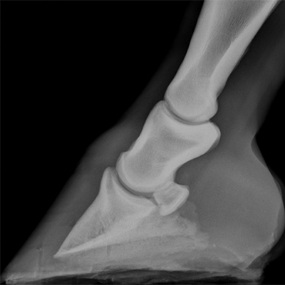 normal foot xray lateral