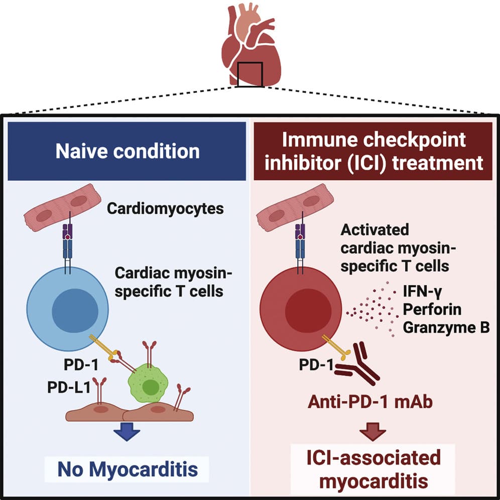 Diagram showing that anti-PD-1 immune checkpoint inhibitor treatment activates cardiac myosin-specific T cells, leading to immune-mediated myocarditis, whereas normal PD-1/PD-L1 signaling prevents myocarditis.