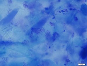 Malassezia (broad-based budding yeasts)