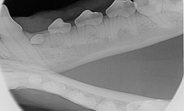 mandibular premolars