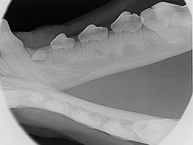 mandibular premolars