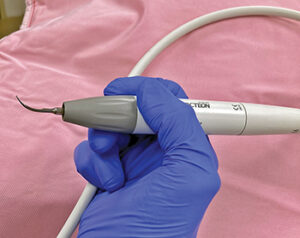 Modified pencil grip with cord under pinky finger.