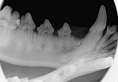 unerupted mandibular first premolar teeth